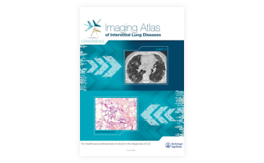 Imaging Atlas of Interstitial Lung Diseases_1