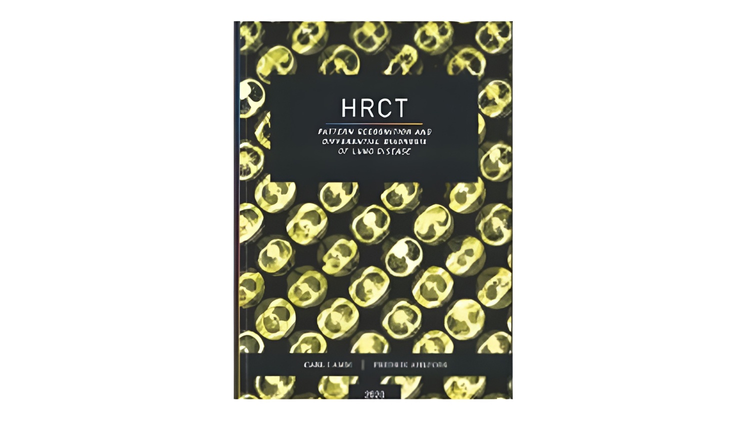 HRCT bok engelsk utgave