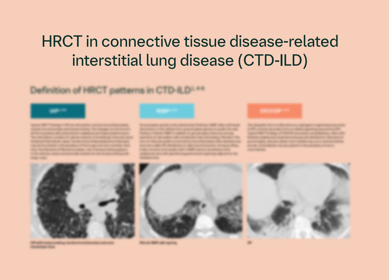 Folder: Diagnostikk av bindevevsrelatert-ILD ved HRCT