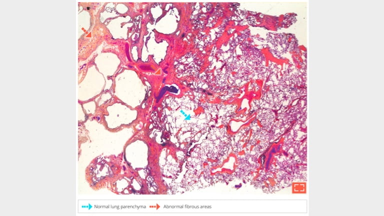 Characteristicpatworkpattern